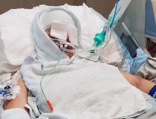 שירה איסקוב בבית החולים (צילום שהשמפחה התירה לפרסם בתקשורת)