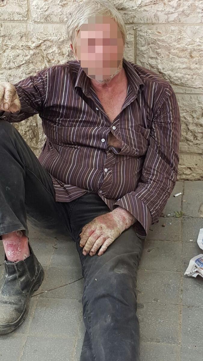 דר רחוב, שידיו ורגליו זקוקים לטיפול רפואי דחוף, אך הוא שקוף למערכת