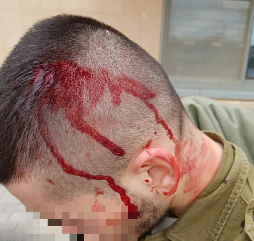 אחד החיילים הפצועים (צילום: מתוך רשתות חברתיות)