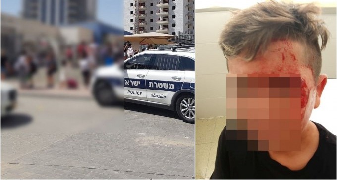 קטטה בבית הספר היסודי בשכונה היוקרתית: ''ילד הוכה בפניו ומדמם''
