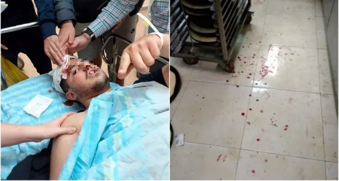 תקיפת הנערים במרכז אורן: שני עצורים נוספים, בני 25 מלקיה