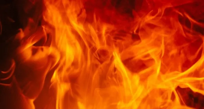 תאונה מחרידה: ילדה שפכה מדלל צבע למדורה - ונכוותה בכל חלקי גופה