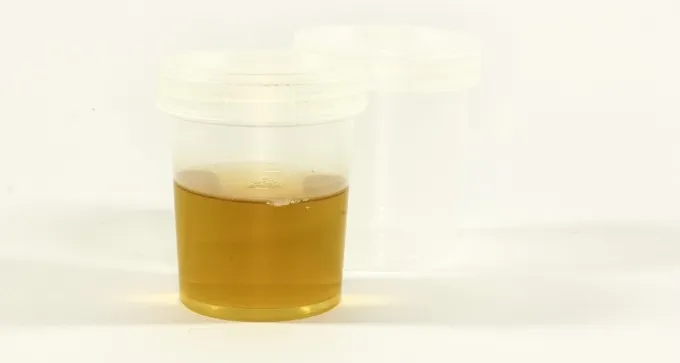 מטופל שפך על אחות בדיקת שתן, כי ביקשה ממנו לעטות מסכה