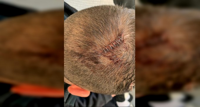 האלימות במרכז אורן: נערים הותקפו באכזריות, התושבים חיים בפחד