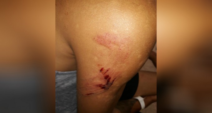 בחור אמיץ: הציל ילדה ממוות בטוח בשכונה ד'