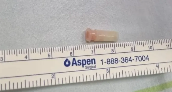 סורוקה: ניצלו חייה של פעוטה ששאפה צפצפה