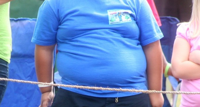 מדאיג: באר שבע מובילה באחוז הילדים השמנים