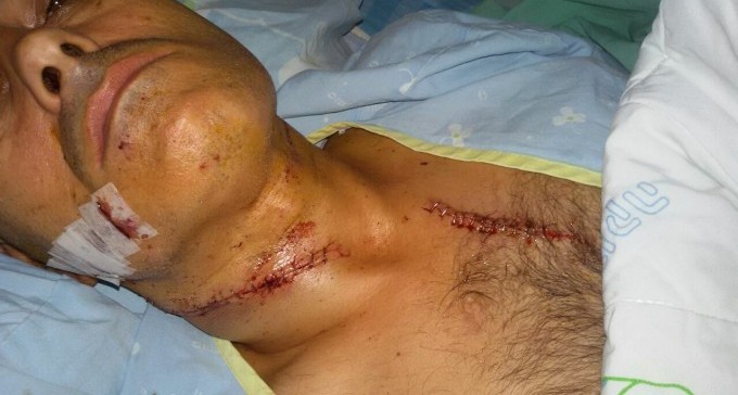 פני הרוע: תיעוד הדקירה בפיצה גוטה