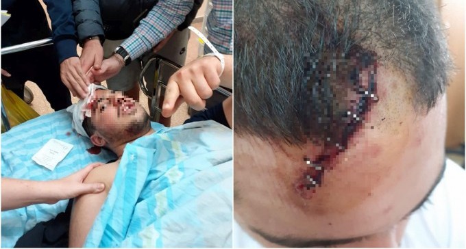 תקיפת הנערים באורן: ''חוששים להסתובב בעיר, אולי נהיה הקורבן הבא''