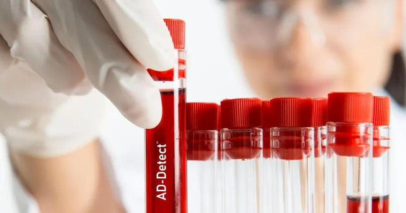 בדיקת דם פשוטה, הזמינה בבאר שבע, תאפשר אבחון מוקדם של אלצהיימר