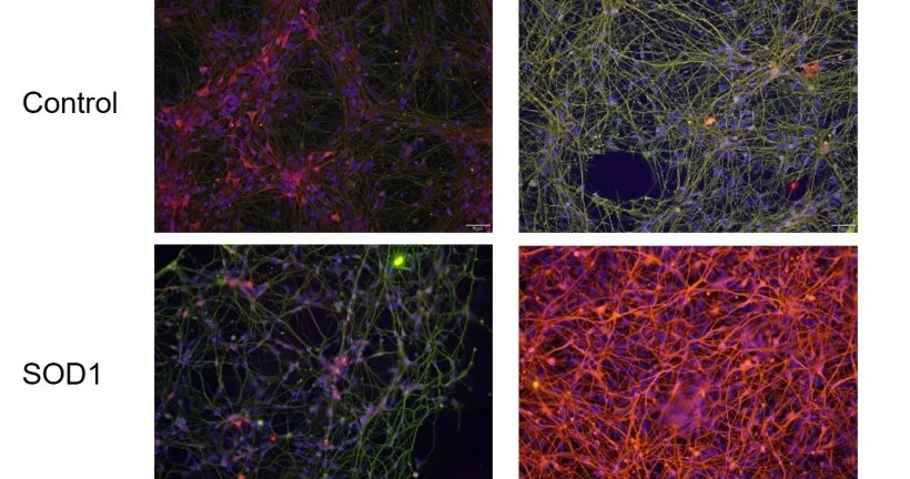 גישה חדשנית למחלת ALS: העלאת רמות החלבון MIF בתאי עצב