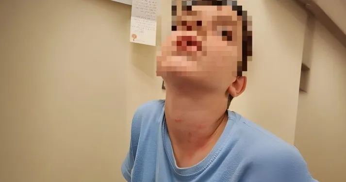 מזעזע: ''ילד תקף שני תלמידי כיתה ב' בבאר שבע - ורדף אחרי מורה עם סכין''