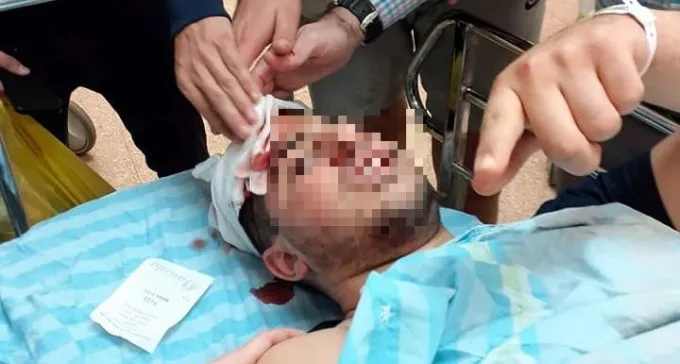 נעצר חשוד בתקיפת הנערים בפיצריה באורן: תושב לקיה בן 25