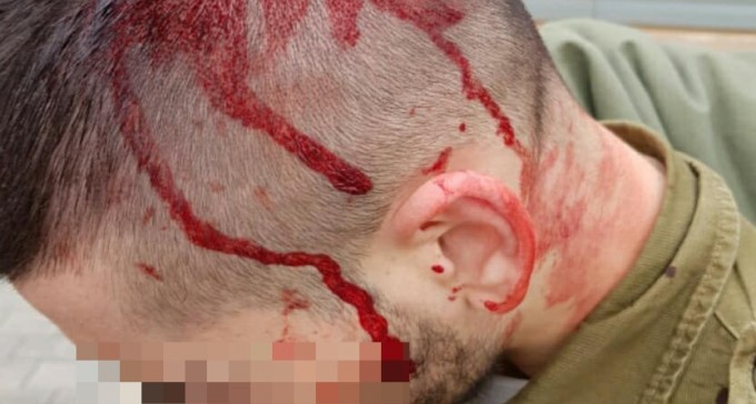 קטטה המונית בבסיס גדול בנגב: יותר מעשרה חיילים נפצעו