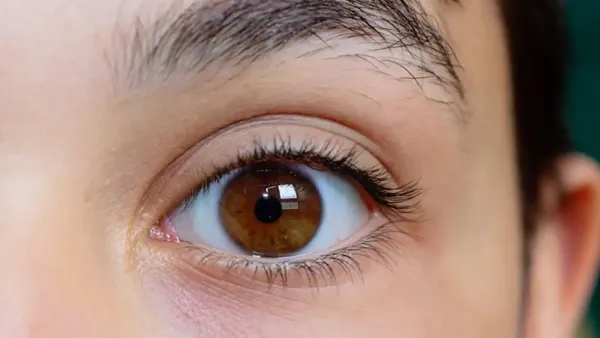 מחלות עיניים שפוגעות בראיה – כדאי וחשוב לטפל